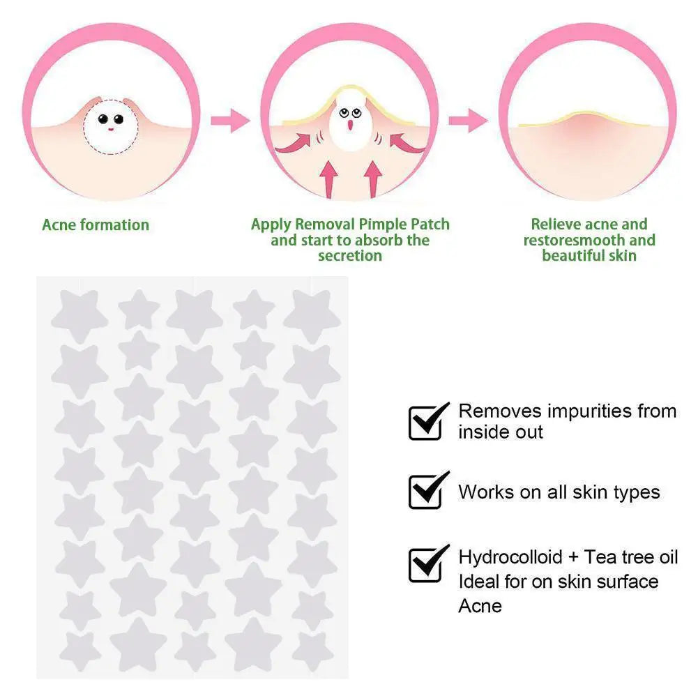 40pcs Star-Shaped Hydrocolloid Pimple Patches – Colorful Cover Pimple Patches Richie's