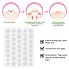 40pcs Star-Shaped Hydrocolloid Pimple Patches – Colorful Cover Pimple Patches Richie's