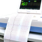 Thermal ECG Printer Paper Roll – Clear Grid 50/63/80/110mm ECG Printer Paper Richie's