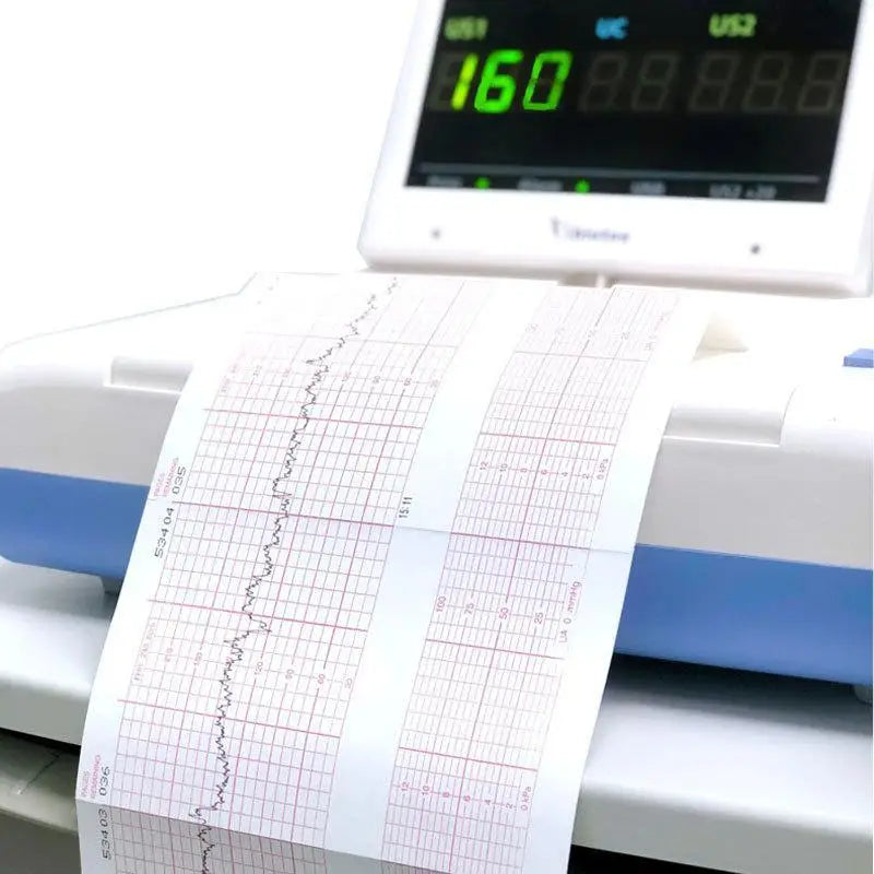 Thermal ECG Printer Paper Roll – Clear Grid 50/63/80/110mm ECG Printer Paper Richie's