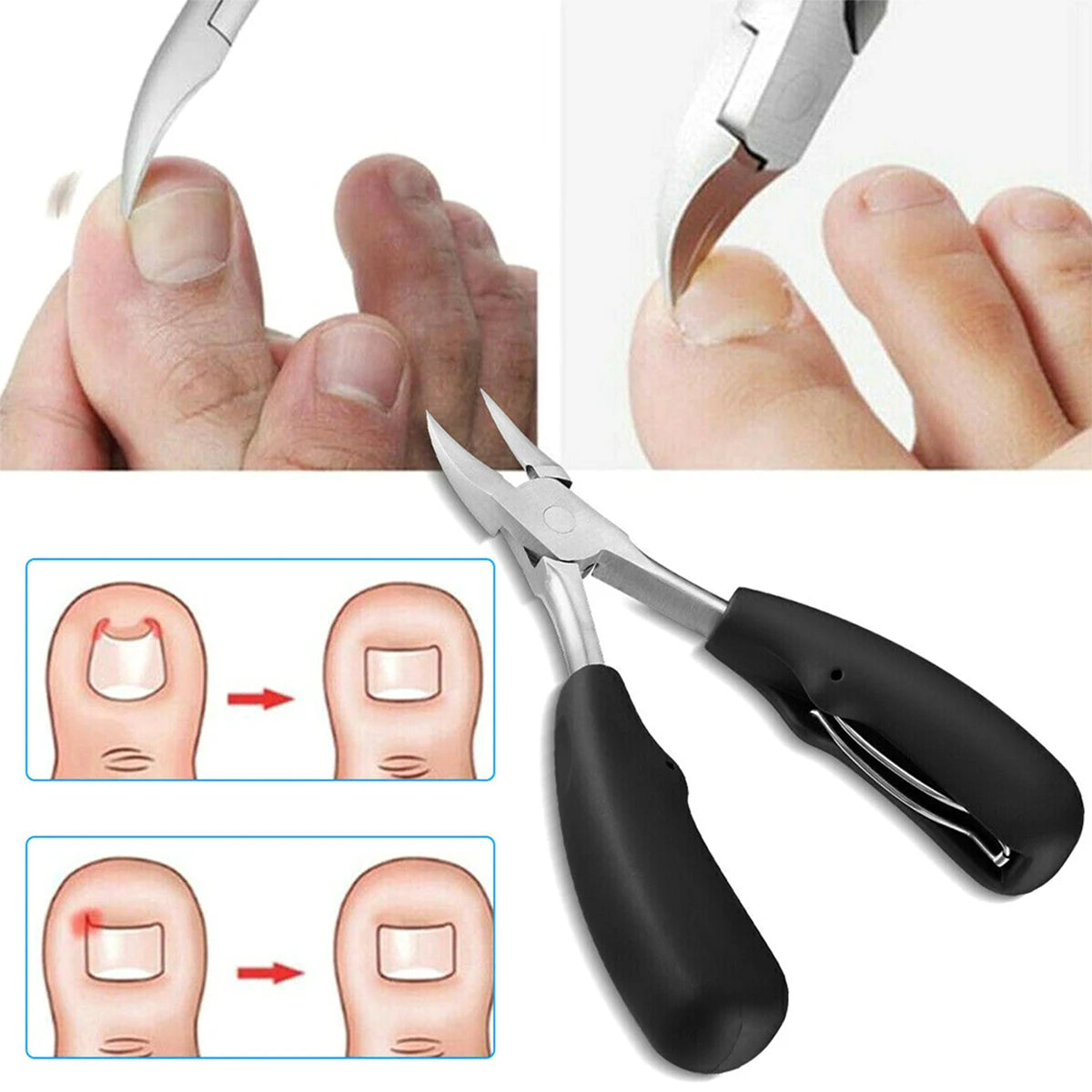 Toenail Clipper for Thick Nails & Cuticle Nipper – Stainless Steel Nail Clipper Richie's