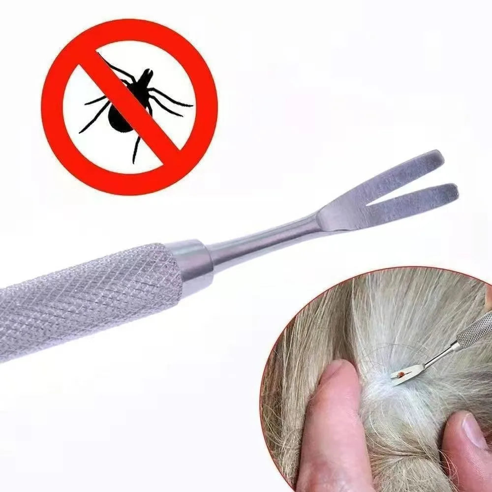 Stainless Steel Tick Removal Fork Tool for Pets – 11.5cm Tick Removal Tool Richie's