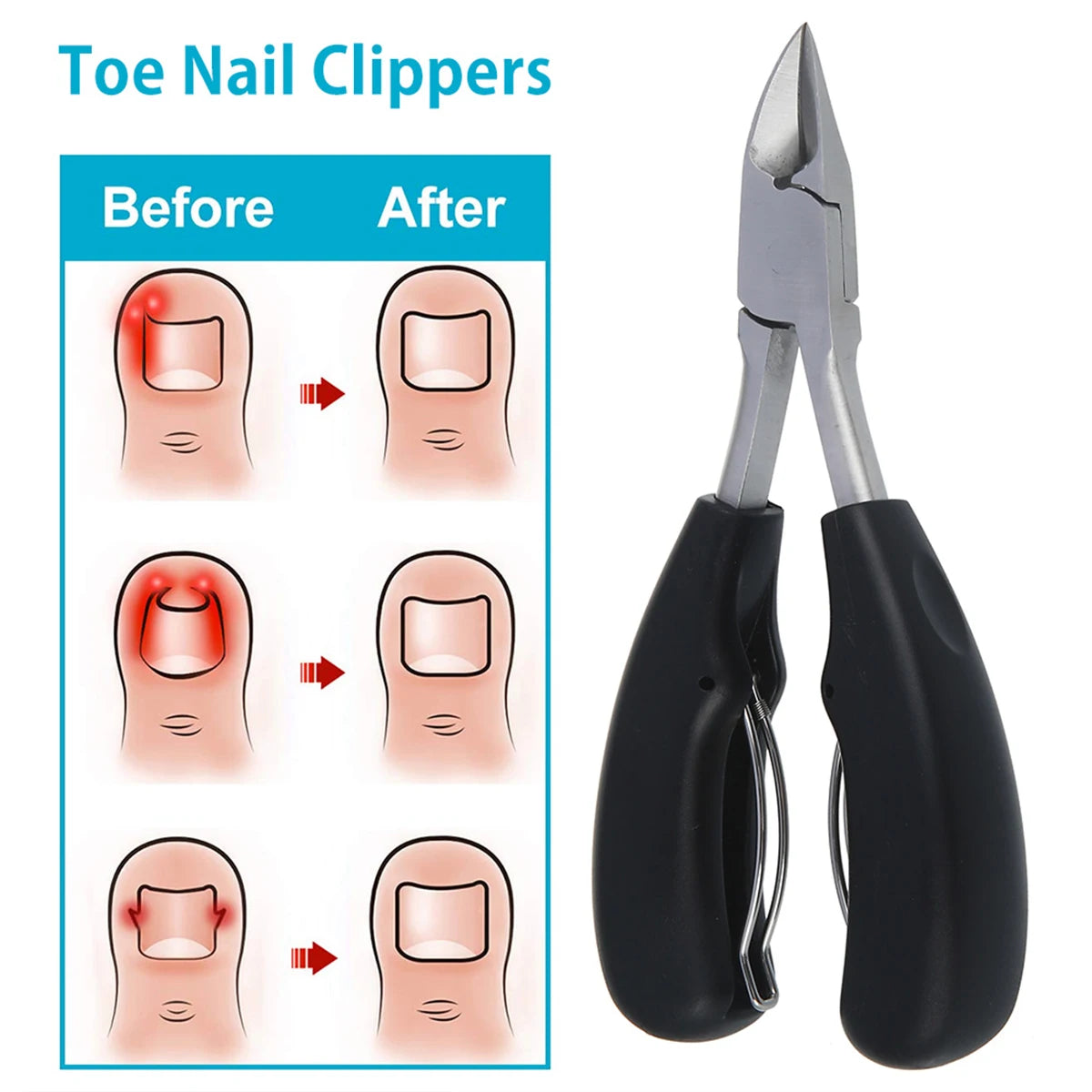 Toenail Clipper for Thick Nails & Cuticle Nipper – Stainless Steel Nail Clipper Richie's